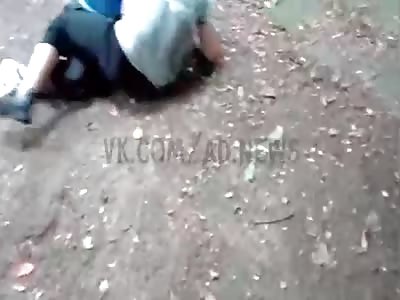 Broke his leg in a school fight.