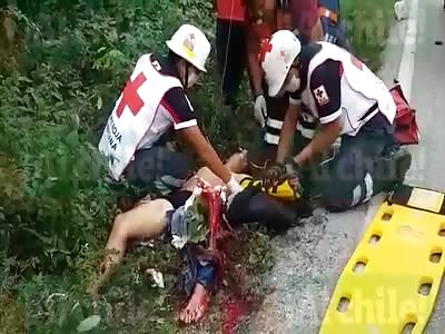 AFTERMATH ACCIDENT....