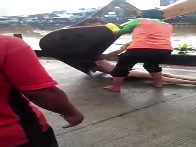 Dead Boy With Internal Organ Taken Out  for  Black Market