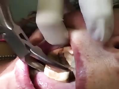 Haven't had a dentist visit for a while