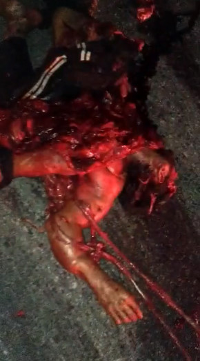 Scooter Guy Turned Into Ketchup