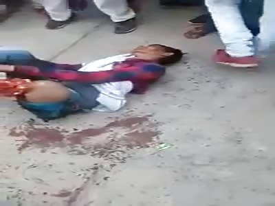 HOLY SHIT: Both Legs Ripped Off at the Calve