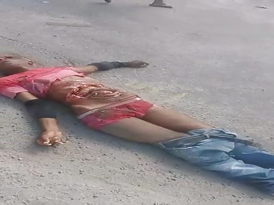 man was unrecognizable in shocking accident