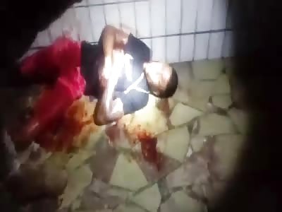 terribly injured boy