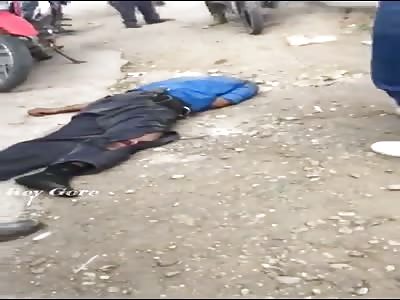 man injuried  victim of accident