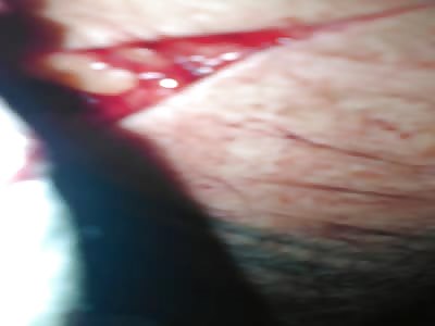 aftermath of machete attack in Gwent, Wales