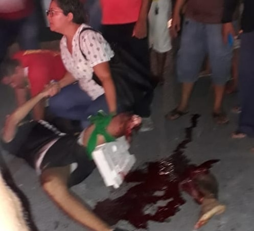 Biker Loses Leg After Accident