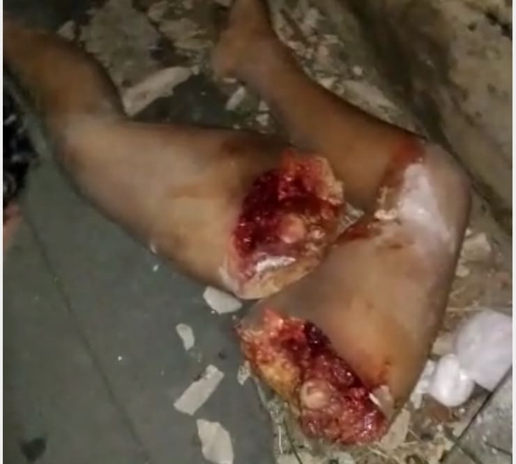 Nothing Found but the Legs