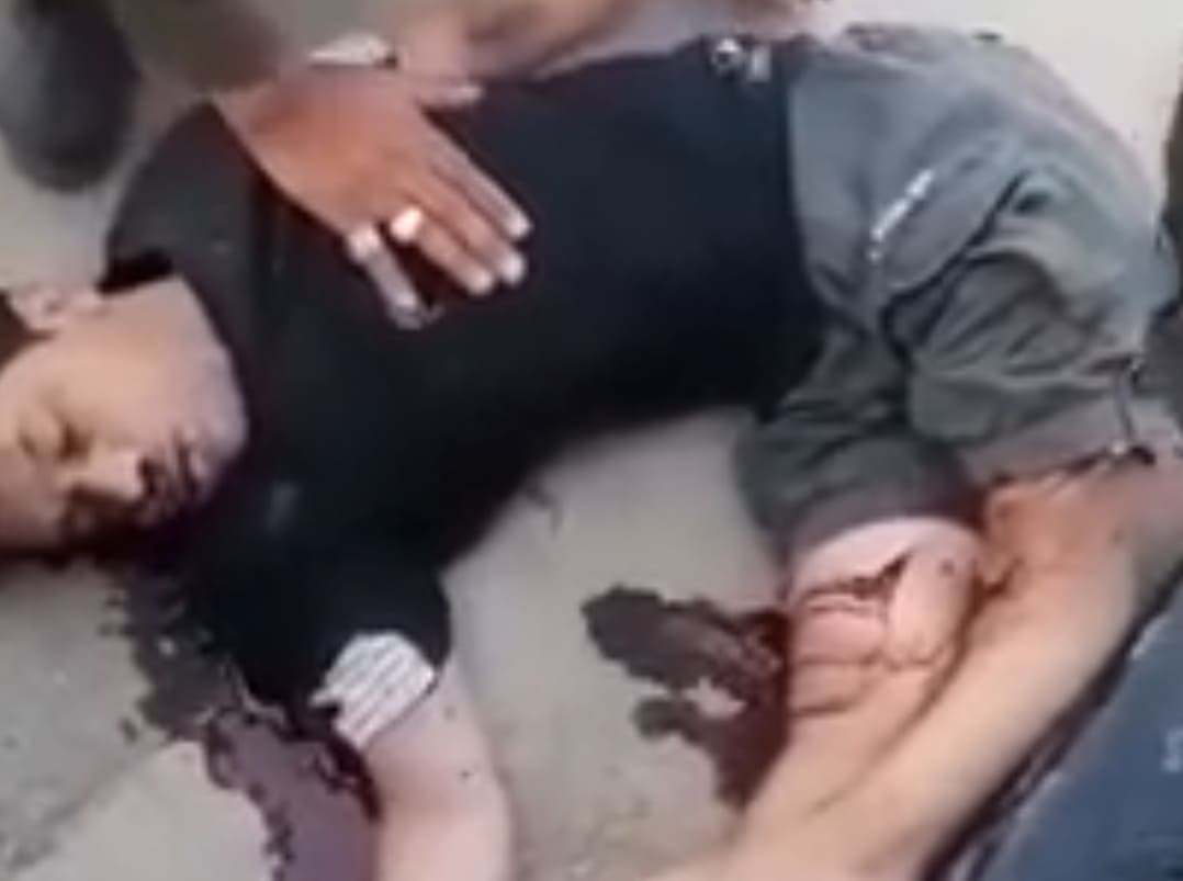 Motorbikers Knees Blown Back After Accident