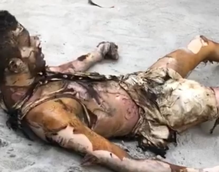 Gas Explosion Leaves Men Toasted