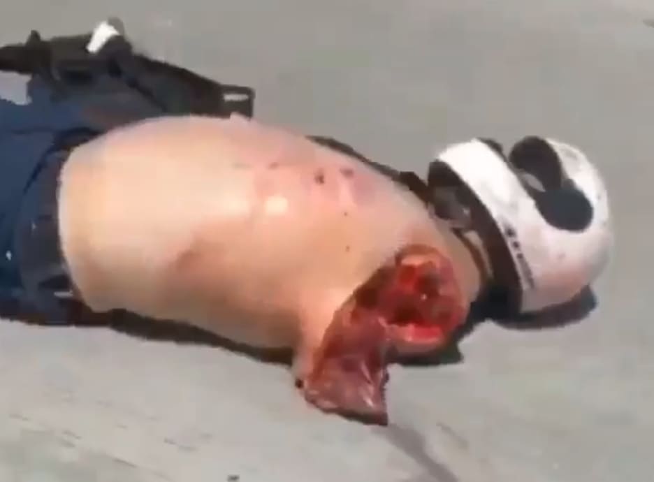 California Biker Killed, Loses Arm in Accident