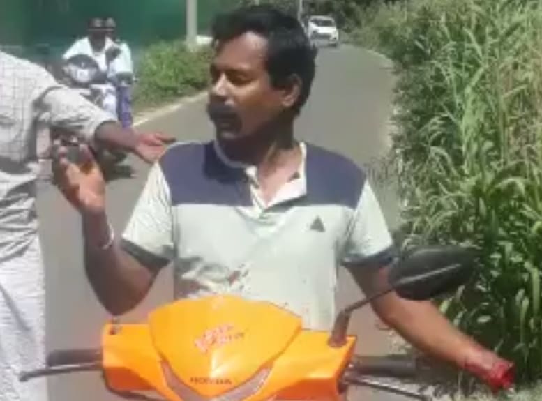 Hand Chopped Off and Casually Driving a Bike
