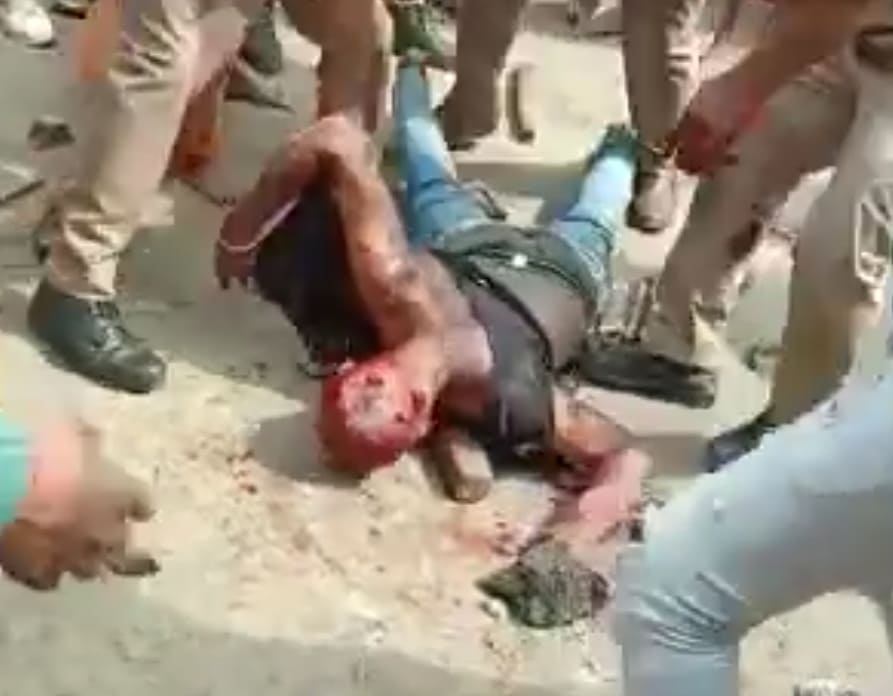 Eye For an Eye (Two Angles)