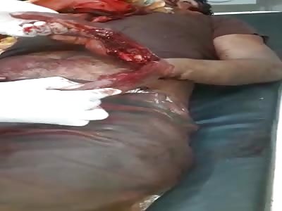 Dude Gets Hacked Up by His Son