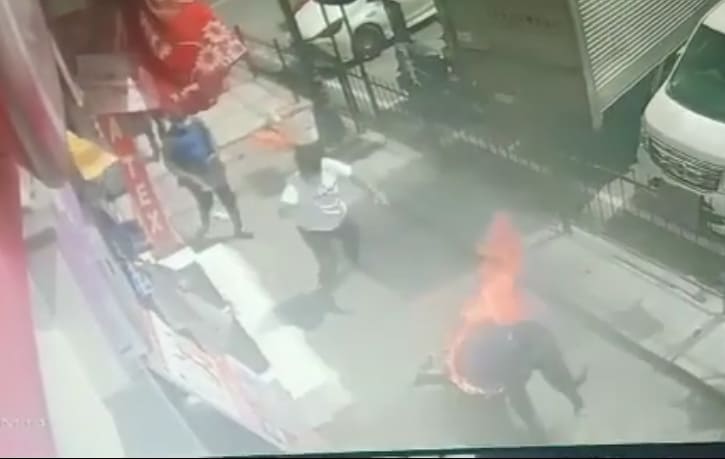 Woman Accidentally Set On Fire