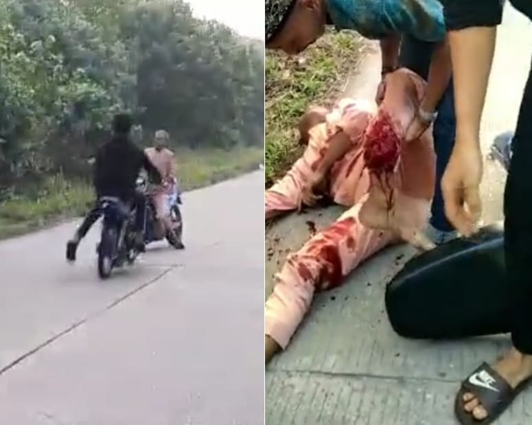 Won't Be Walking That Off