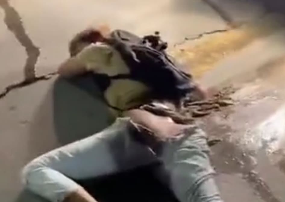 Sir... Your Intestines Are Hanging Out