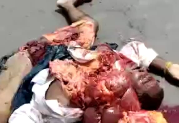 DAMN! Man Turned Inside Out With Heart Still Beating