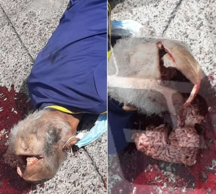 Hit And Run Leaves Elderly Man's Skulled Cracked Open