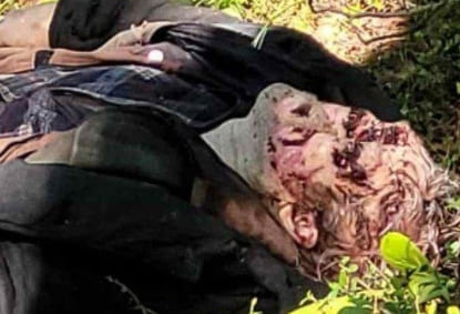 DAMN: Hunters Skull Caved In By Wounded Bear