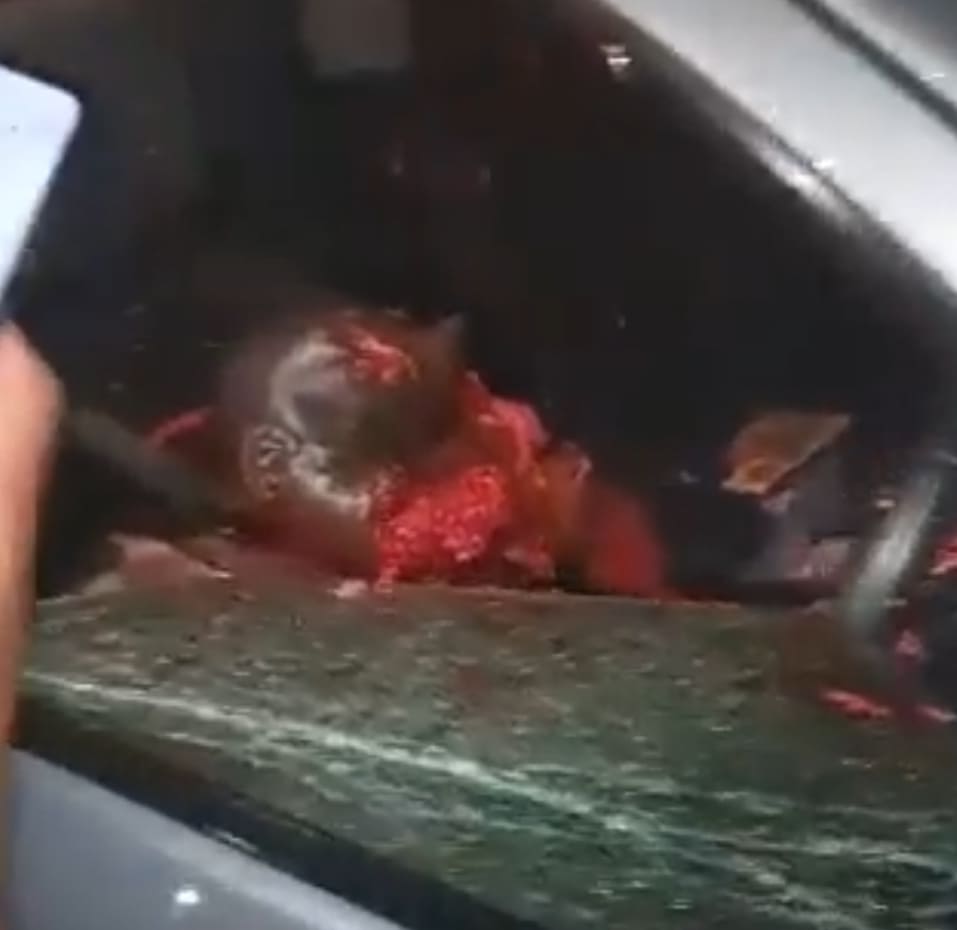 Gunmen Leave Dude Unrecognizable 