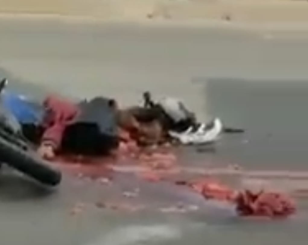 Cement Truck Smears Biker Across The Pavement