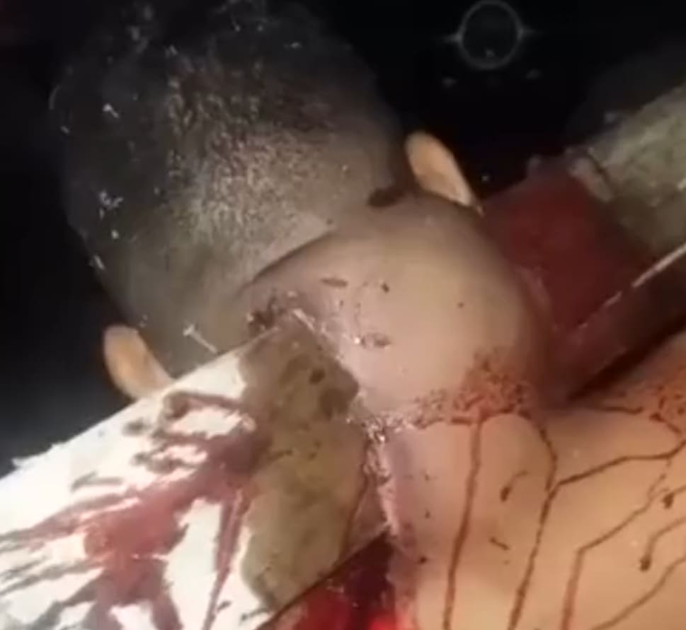 Dude Impaled With Fence Post