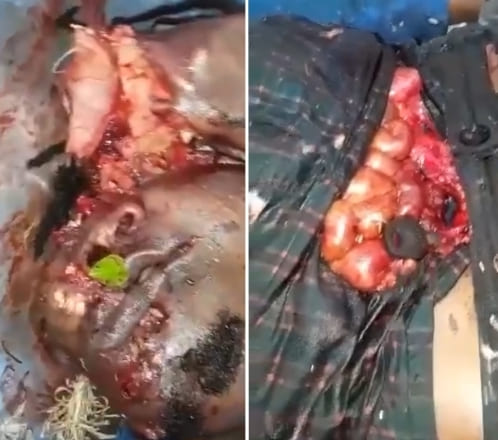 Dude Hacked Up By Girlfriend's Ex