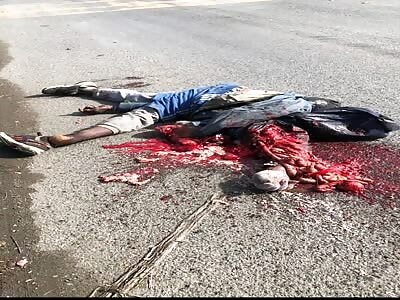 Truck Leaves Biker Fucked Up Beyond Recognition 