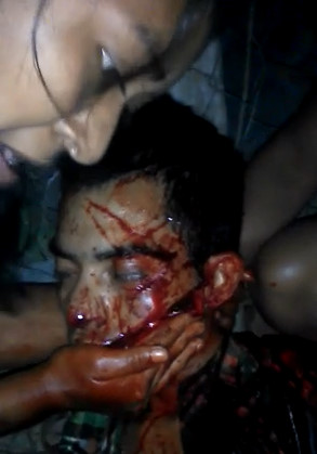 This Is Not A Halloween Mask And He Is Wide Awake