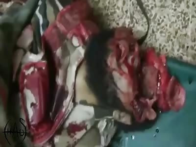 War Victims Compilation 