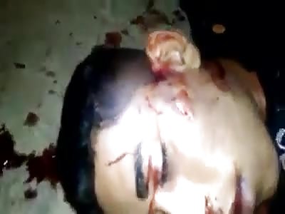 dead with bullet holes