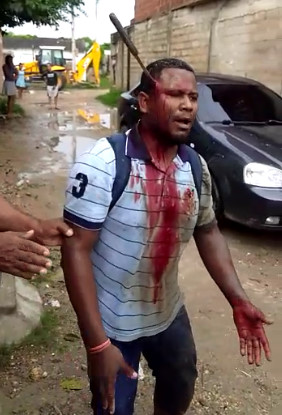 Dude Takes Knife to the Head Protecting Mom From Psycho Boyfriend