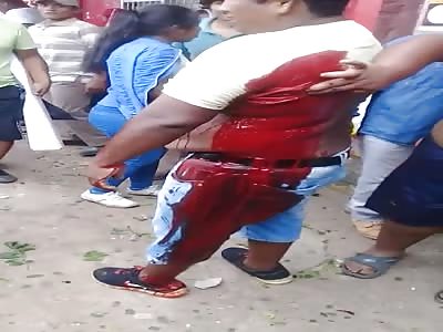 Man blooding after stabbed