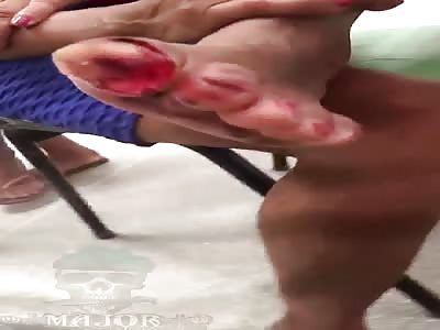 attacked by piranhas