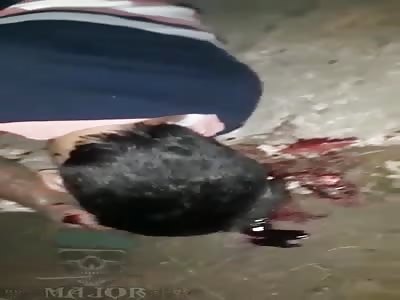 young man in agony with headshot