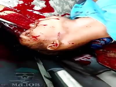 Man victim of horrific accident