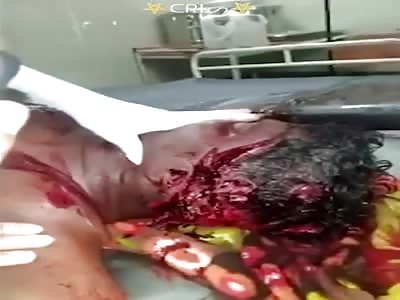 man with his head destroyed