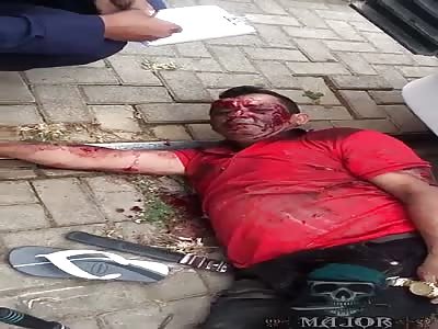 bumpy cyclist waiting for help