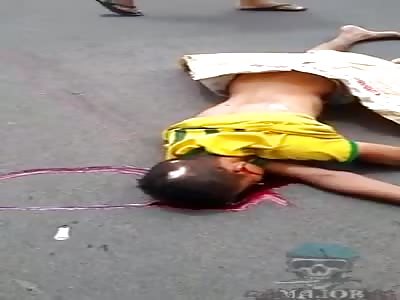 victim of horrible accident