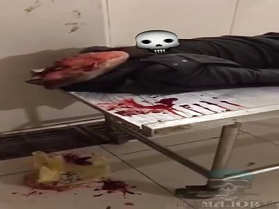 body with head crushed