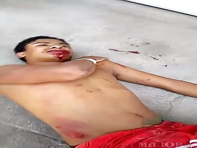 boys injured in a motorcycle accident