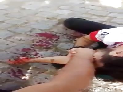 Man injuried after accident with fireworks