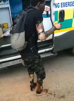 Roasted Alive on High Voltage Cables