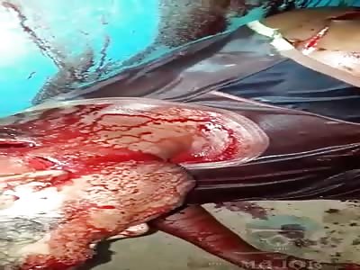 dead man with several stabs