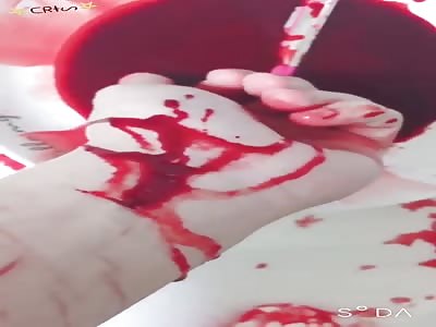 self-mutilation 4