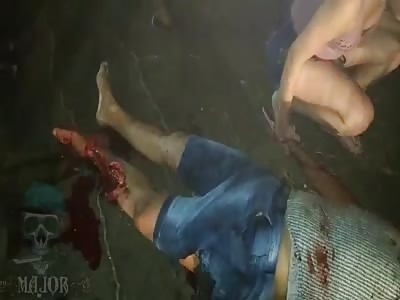 Pretty Girl Comforts the Accident Victim.