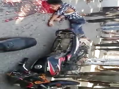 Biker got a headache