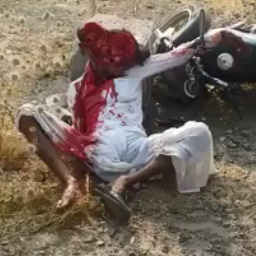 Someone Forgot to Put on a Helmet