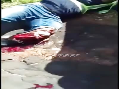 victim of terrible accident